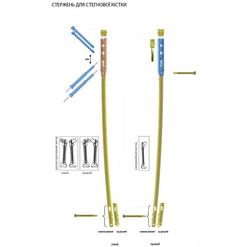 Стержень універсальний для інтрамедулярного остеосинтезу стегнової кістки Charfix